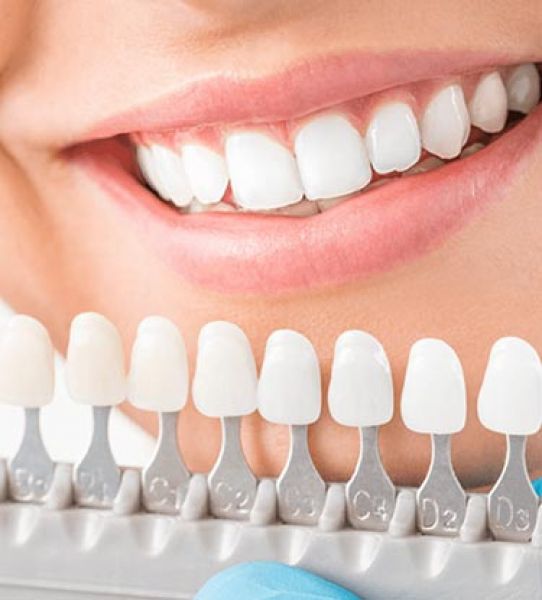 Estetik Diş Hekimliği